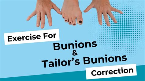 Exercise for Bunion and Tailor's Bunion (Bunionette) Correction - YouTube