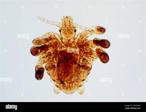 Light micrograph of the pubic louse, Phthirus pubis, also known as the crab louse. An ...