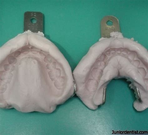 Alginate Impression material | Alginate Dental Impression