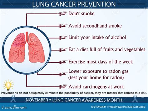 Lung Cancer Prevention Infographic Vector Illustration Stock Vector - Illustration of treatment ...