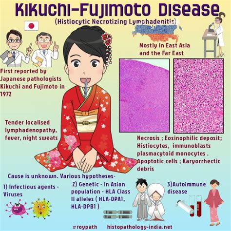 Kikuchi-Fujimoto disease (KFD) - histiocytic necrotizing lymphadenitis