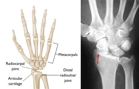 Wrist Joint Diagram