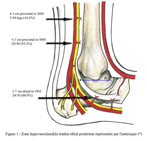 Tibialis Posterior Tendon Palpation