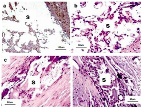 Histology images of cells that infiltered into the vascular grafts ...