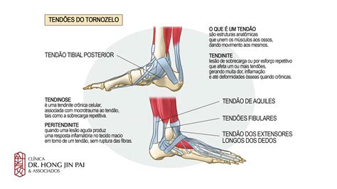 Dor no tornozelo: principais causas e tratamentos