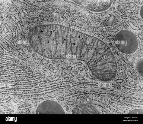 Mitochondria Electron Micrograph Labelled