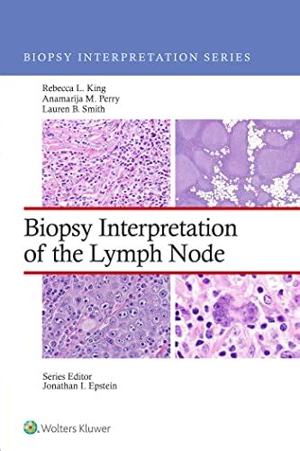 Biopsy Interpretation of the Lymph Node (Biopsy Interpretation Series ...