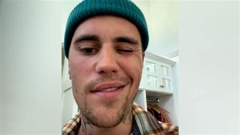 Justin Bieber shocks fans after he reveals his face is PARALYZED by ...