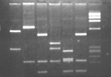 Electrophoresis | Dna sequence, Dna gel electrophoresis, Science art