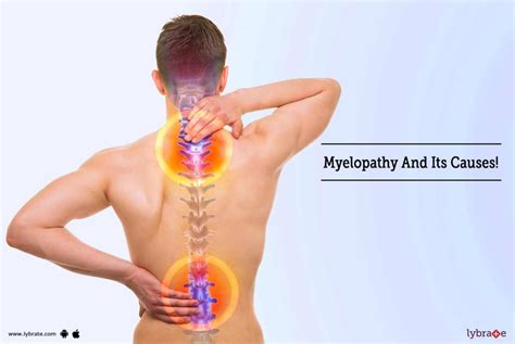 Myelopathy And Its Causes! - By Dr. S.S Sanyal | Lybrate