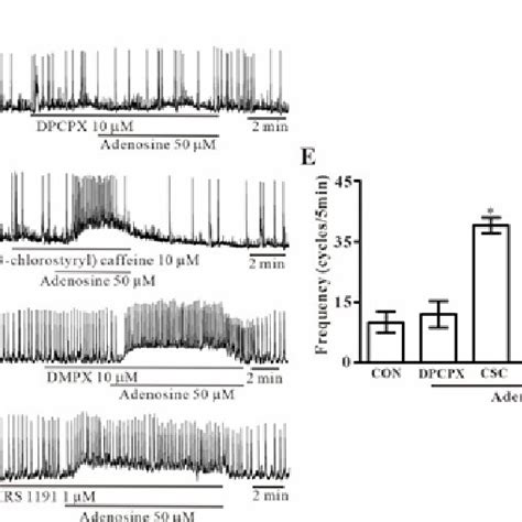 Effects of adenosine receptor antagonists on adenosine-induced action ...