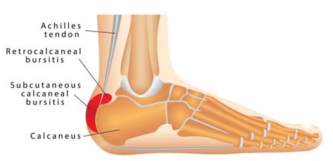 Achilles Tendon (Human Anatomy): Function, Location, and Injuries ...