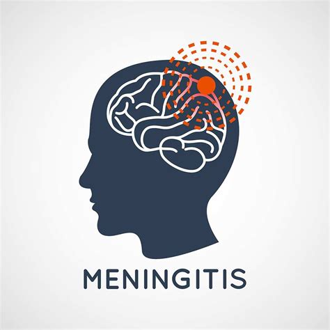 Meningitis Symptoms; 11 Most Important Signs & Symptoms