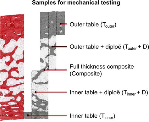 A picrosirius red-stained neurocranial bone sample is depicted to... | Download Scientific Diagram