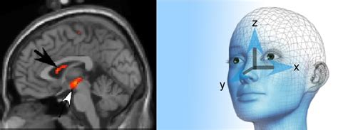 Ventral Tegmental Area & Caudate Nucleus