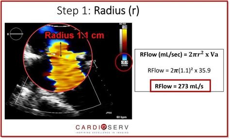 A Complete Guide to Performing MR PISA! Cardiac Sonography, Sonography Student, Vascular Disease ...