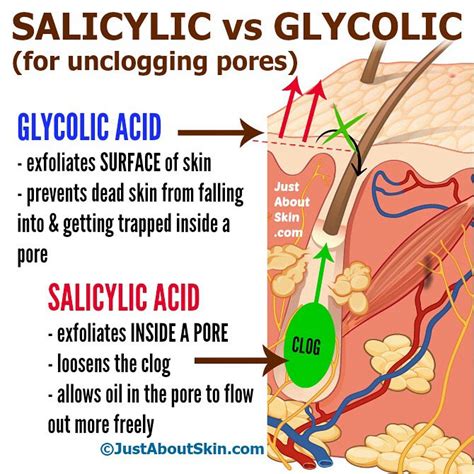 Salicylic Acid vs Glycolic Acid For Unclogging Pores - Just About Skin