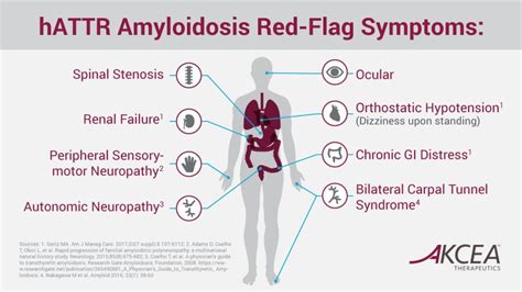 Do You Have Amyloidosis? Signs & Symptoms for AL, Wild Type and hATTR – NZ Amyloidosis Patients ...