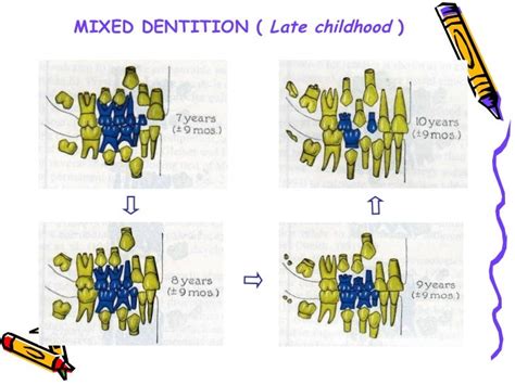 the-mixed-dentition-pedodontics