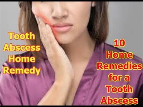 tooth abscess home remedy | 10 Home Remedies for a Tooth Abscess - YouTube