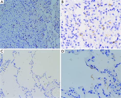 Immunohistochemical staining of the patient and a healthy control. (A ...