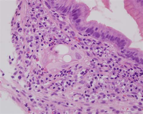 Histopathology Reviewed - Peeriodicals