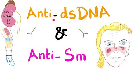 Anti-dsDNA vs Anti-Smith Antibodies - YouTube