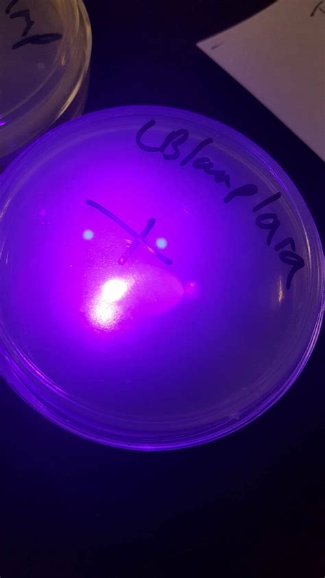 Genetic Engineering: Bacterial Transformation Lab – ibrittanycasillas
