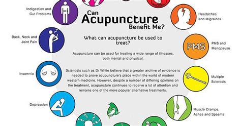 Benefits of Acupuncture