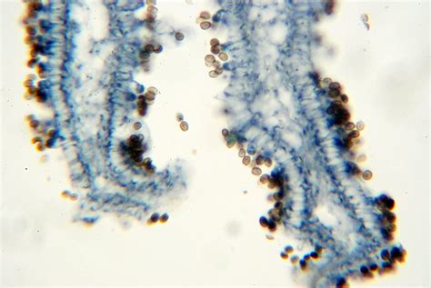 Free Fungus - microscopic view of sporocarp 3 Stock Photo - FreeImages.com