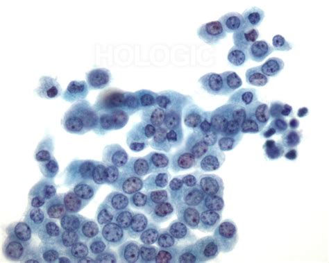 normal serosa cytology