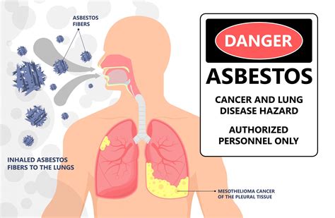 Asbestos Guide - Management & Removal | First Response Ottawa