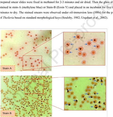 Microscopic examination of Stain-A (methylene blue) and Stain-B (Eosin ...