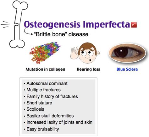 Rosh Review | Osteogenesis imperfecta, Pediatric nursing, Brittle bone