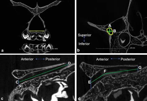 Measurements of the infraorbital canal. a Coronal section indicating... | Download Scientific ...