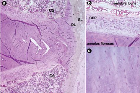 Annulus Fibrosus Histology