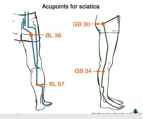 How To Relieve Sciatica Pain With Stretches – Brandon Orthopedics