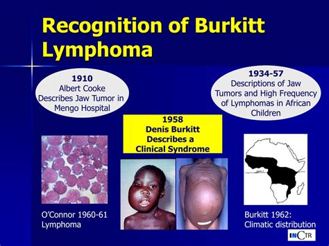 PPT - Burkitt lymphoma: Clues to Epidemiology PowerPoint Presentation ...