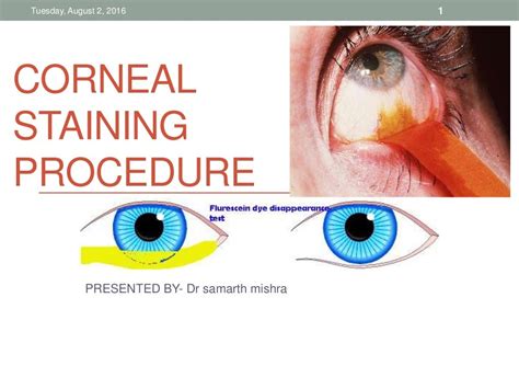 Corneal staining procedure