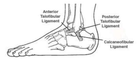 Rolled ankle treatment and physiotherapy. Optimise Physio Sydney.