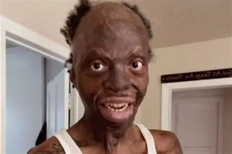 The Ugliest Black Man In The World