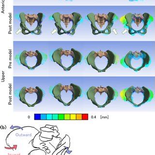 (a) Resultant displacement vector diagrams of the pelves on anterior... | Download Scientific ...