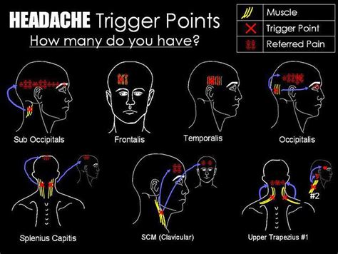 Pressure Points For Headache Relief Diagram : 7 Pressure Points Proven to Relieve The Worst ...