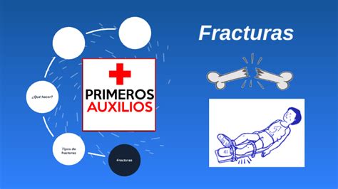 Fracturas primeros auxilios by Antonia Peña on Prezi