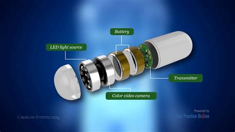 Capsule Endoscopy Video | Medical Video Library