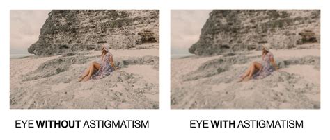 Astigmatism: What it is, Causes and Operation - Oftalvist