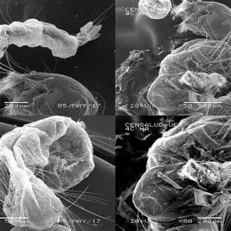 Front view of stage I of larvae of Aedes aegypti, which is divided into ...