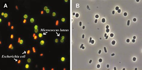 Mixed culture (1:1) of M. luteus (gram-positive cocci) and E. coli... | Download Scientific Diagram