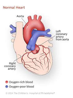 ALCAPA: Anomalous Left Coronary Artery From the Pulmonary Artery ...