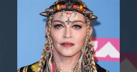 Madonna's Bizarre Face Transformation — Plastic Surgeons Weigh In